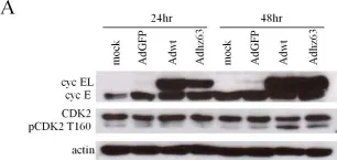 Fig.3.A showing Western Blotting from the publication: Molecular basis for viral selective replication in cancer cells: activation of CDK2 by adenovirus-induced cyclin E.