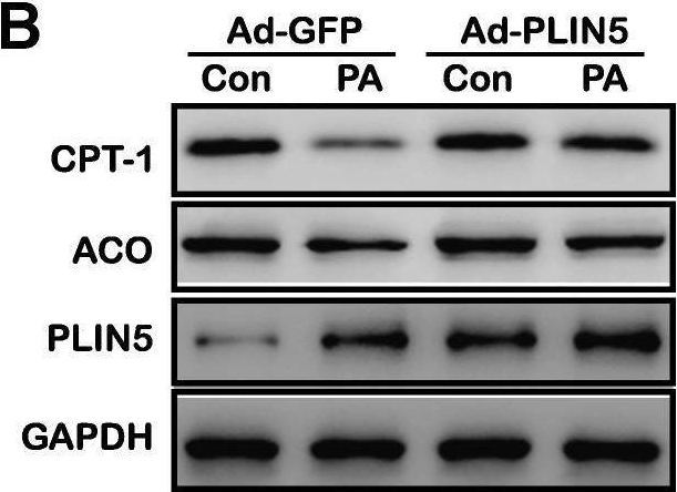 Perilipin5 protects against lipotoxicity and alleviates endoplasmic reticulum stress in pancreatic β-cells.