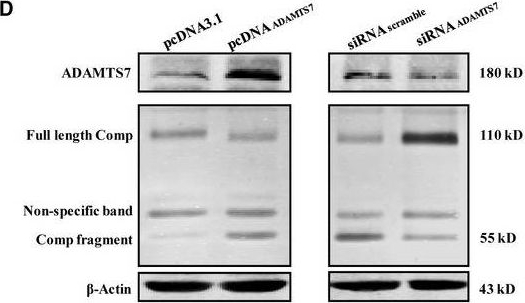 Fig.5.D showing Western Blotting in a Homo sapiens (Human) sample from the publication: ADAMTS7 degrades Comp to fuel BMP2-dependent osteogenic differentiation and ameliorate oncogenic potential in osteosarcomas.