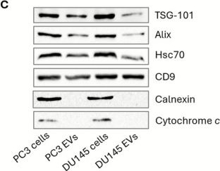 Fig.1.C showing Western Blotting in a Mus musculus (House mouse) sample from the publication: Extracellular Vesicles Released From Prostate Cancer Cells Confer Pro-Tumor Properties to Adipocytes by Stimulating Lipolysis.