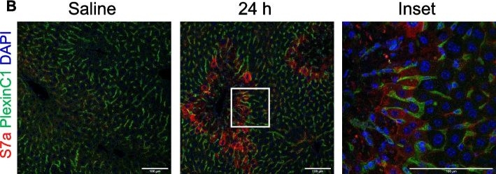 Fig.3.B showing Immunohistochemistry-immunofluorescence in a Mus musculus (House mouse) sample from the publication: Semaphorin 7a is protective through immune modulation during acetaminophen-induced liver injury.