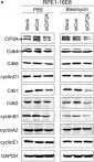 Fig.4.A showing Western Blotting from the publication: CIP2A facilitates the G1/S cell cycle transition via B-Myb in human papillomavirus 16 oncoprotein E6-expressing cells.