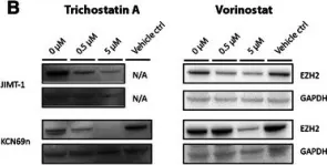 Fig.6.B showing Western Blotting from the publication: DNA methylation and histone modifications regulate SOX11 expression in lymphoid and solid cancer cells.