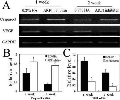 Fig.3.A showing Western Blotting from the publication: ADP-ribosylation factor as a novel target for corneal neovascularization regression.