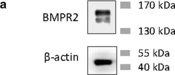 Fig.2.A showing Western Blotting in a Homo sapiens (Human) sample from the publication: Identification of a bone morphogenetic protein type 2 receptor neutralizing antibody.