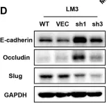Fig.3.D showing Western Blotting from the publication: SHC4 promotes tumor proliferation and metastasis by activating STAT3 signaling in hepatocellular carcinoma.