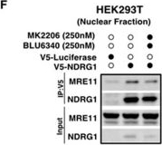 Fig.3.F showing Western Blotting from the publication: Interaction of NDRG1 and MRE11 Modulates DNA Replication and Repair.