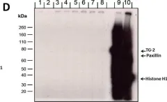 Fig.4.D showing Western Blotting from the publication: Mechanistic role of transglutaminase-2 in focal adhesions.