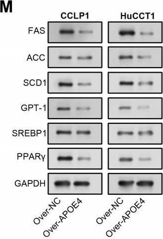 Fig.5.M showing Western Blotting in a Homo sapiens (Human) sample from the publication: Regulation of lipid metabolism by APOE4 in intrahepatic cholangiocarcinoma via the enhancement of ABCA1 membrane expression.