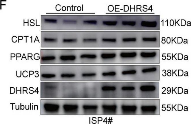 Fig.3.F showing Western Blotting in a Homo sapiens (Human) sample from the publication: Cold-Induced DHRS4 Promotes Thermogenesis via Enhanced Fatty Acid β-Oxidation in Porcine Subcutaneous Adipocytes.