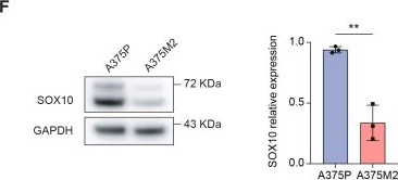 Fig.4.F showing Western Blotting from the publication: Pan-cancer analysis reveals Rho kinase addiction as a vulnerability of de-differentiated cancer cells.