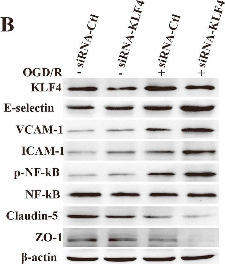 Fig.6.B showing Western Blotting in a Mus musculus (House mouse) sample from the publication: KLF4 alleviates cerebral vascular injury by ameliorating vascular endothelial inflammation and regulating tight junction protein expression following ischemic stroke.