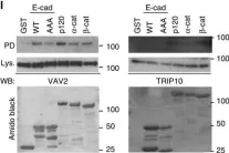Fig.7.I showing Western Blotting in a Homo sapiens (Human) sample from the publication: Defining functional interactions during biogenesis of epithelial junctions.