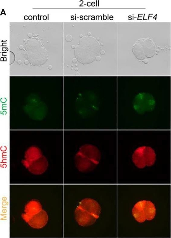 Fig.7.A showing Immunocytochemistry-immunofluorescence from the publication: ELF4 is critical to zygotic gene activation and epigenetic reprogramming during early embryonic development in pigs.