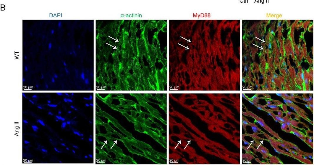 Fig.1.B showing Immunohistochemistry-immunofluorescence in a Mus musculus (House mouse) sample from the publication: Myeloid MyD88 Mediates Macrophage Infiltration and Activation in Ang II-Induced Cardiac Hypertrophy.