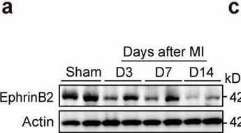 Fig.1.A showing Western Blotting in a Mus musculus (House mouse) sample from the publication: EphrinB2-mediated CDK5/ISL1 pathway enhances cardiac lymphangiogenesis and alleviates ischemic injury by resolving post-MI inflammation.