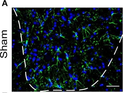 Extracellular Vesicles Can Deliver Anti-inflammatory and Anti-scarring Activities of Mesenchymal Stromal Cells After Spinal Cord Injury.