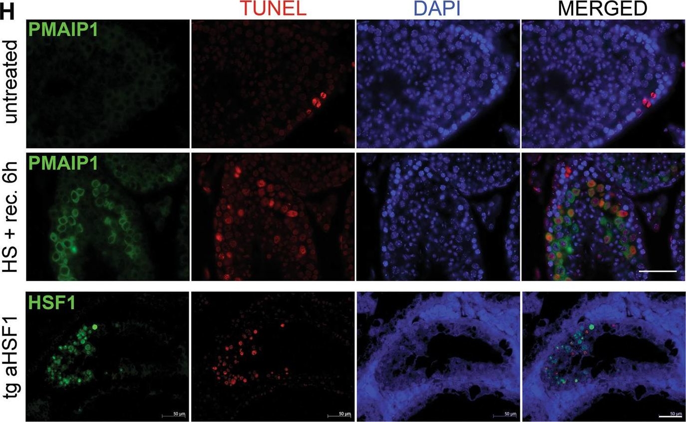 Fig.1.H showing Immunofluorescence in a Mus musculus (House mouse) sample from the publication: Pro-death signaling of cytoprotective heat shock factor 1: upregulation of NOXA leading to apoptosis in heat-sensitive cells.