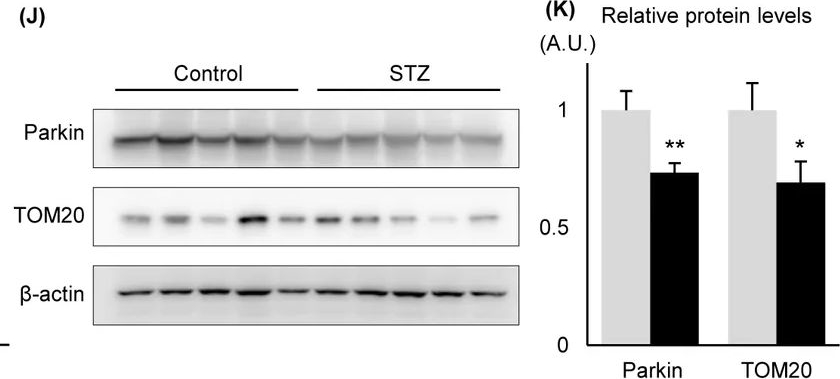 Fig.1.J showing Western Blotting in a Mus musculus (House mouse) sample from the publication: Bone morphogenetic protein 4-associated mitochondrial dysfunction in diabetic nephropathy involves Parkin downregulation.