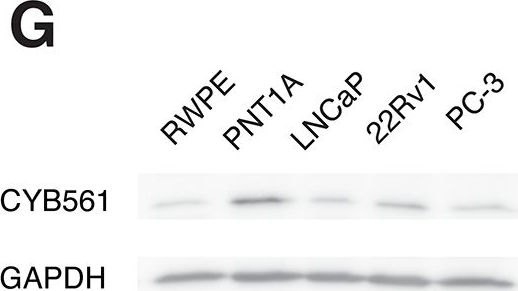 Fig.1.G showing Western Blotting from the publication: CYB561 supports the neuroendocrine phenotype in castration-resistant prostate cancer.