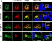 Fig.1.C showing Immunocytochemistry-immunofluorescence in a Homo sapiens (Human) sample from the publication: IGF-1 drives chromogranin A secretion via activation of Arf1 in human neuroendocrine tumour cells.