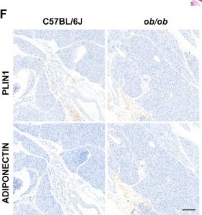 Fig.2.F showing Immunohistochemistry in a Mus musculus (House mouse) sample from the publication: Establishment and Comparative Analysis of Four Mouse Models for the Study of Pancreatic Steatosis.