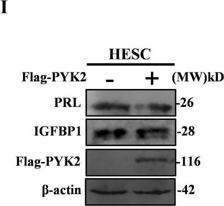 Fig.2.I showing Western Blotting from the publication: PYK2 promotes cell proliferation and epithelial-mesenchymal transition in endometriosis by phosphorylating Snail1.
