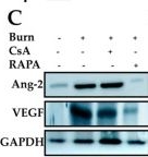 Fig.8.C showing Western Blotting in a Mus musculus (House mouse) sample from the publication: Therapeutic Efficacy of Rapamycin in an Experimental Mouse Model of Corneal Alkali Burn.