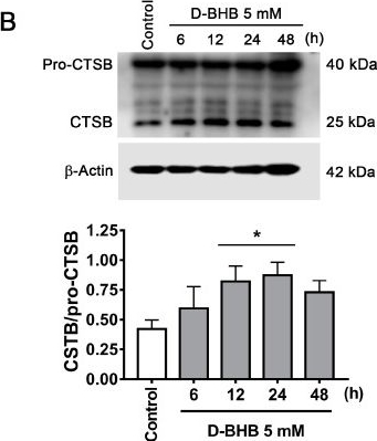 ctsb antibodies - Antibody search engine - CiteAb