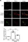 Fig.2.A showing Immunohistochemistry-immunofluorescence in a Rattus norvegicus (Rat) sample from the publication: Vagal afferent fibers contribute to the anti-inflammatory reactions by vagus nerve stimulation in concanavalin A model of hepatitis in rats.