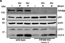 Fig.1.B showing Western Blotting in a Homo sapiens (Human) sample from the publication: Loss of the Essential Autophagy Regulators FIP200 or Atg5 Leads to Distinct Effects on Focal Adhesion Composition and Organization.