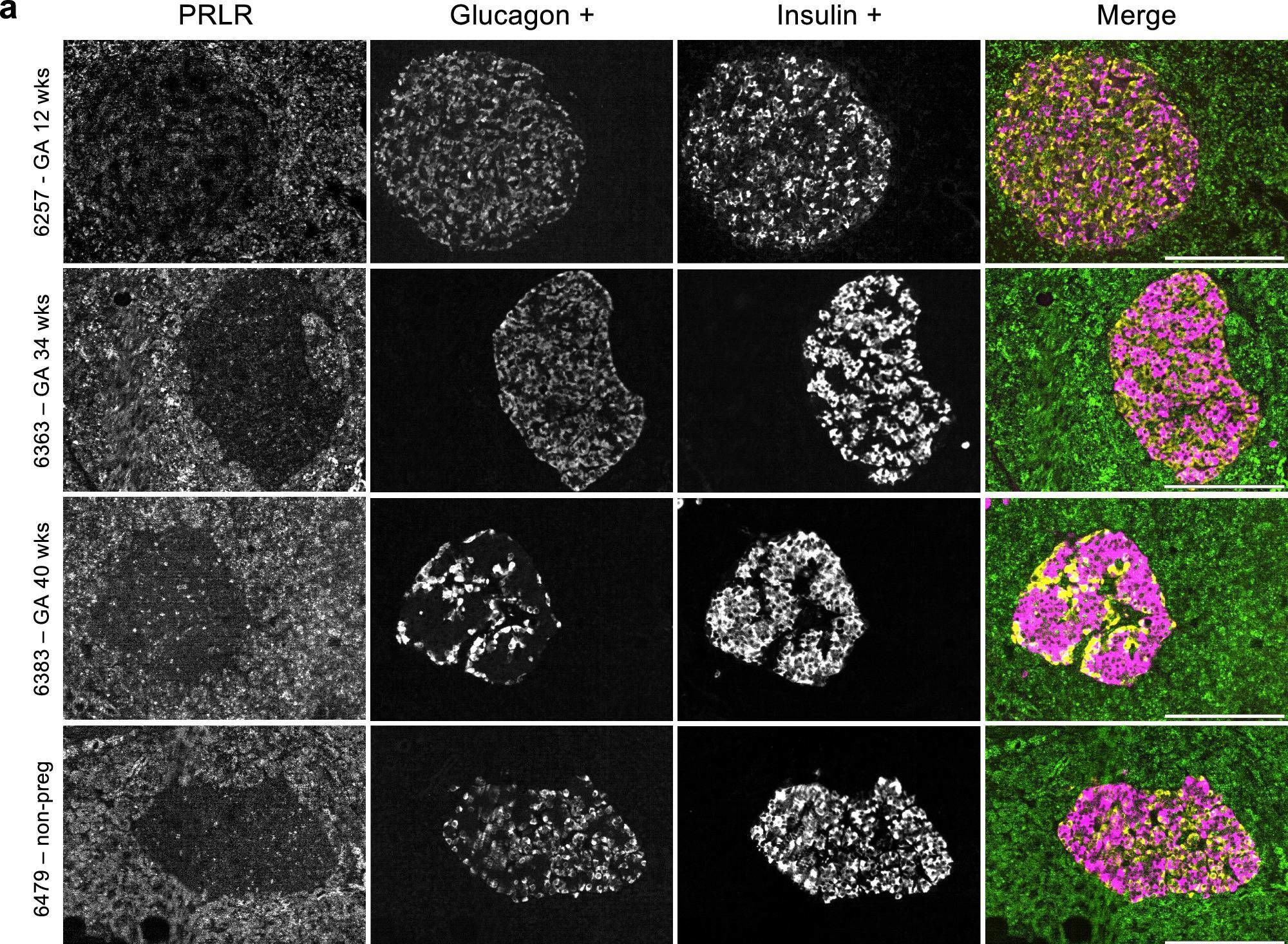 Fig.6.A showing Immunocytochemistry-immunofluorescence in a Homo sapiens (Human) sample from the publication: A new paradigm of islet adaptations in human pregnancy: insights from immunohistochemistry and proteomics.