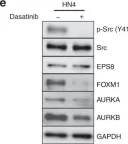 Fig.1.E showing Western Blotting from the publication: EPS8 phosphorylation by Src modulates its oncogenic functions.
