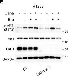 Fig.5.E showing Western Blotting in a Homo sapiens (Human) sample from the publication: Canagliflozin and Brusatol Synergize against LKB1-KEAP1 Co-Mutant NSCLC through AKT Suppression.