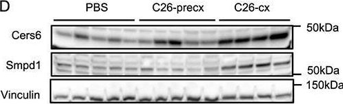 Fig.3.D showing Western Blotting in a Mus musculus (House mouse) sample from the publication: High levels of modified ceramides are a defining feature of murine and human cancer cachexia.