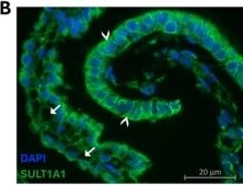 Fig.6.B showing Immunohistochemistry-immunofluorescence in a Rattus norvegicus (Rat) sample from the publication: Developmentally Regulated Expression and Activity of Sulphotransferases in the Rat Choroid Plexuses.