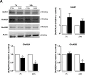 Fig.9.A showing Western Blotting in a Rattus norvegicus (Rat) sample from the publication: In vitro ischemia triggers a transcriptional response to down-regulate synaptic proteins in hippocampal neurons.