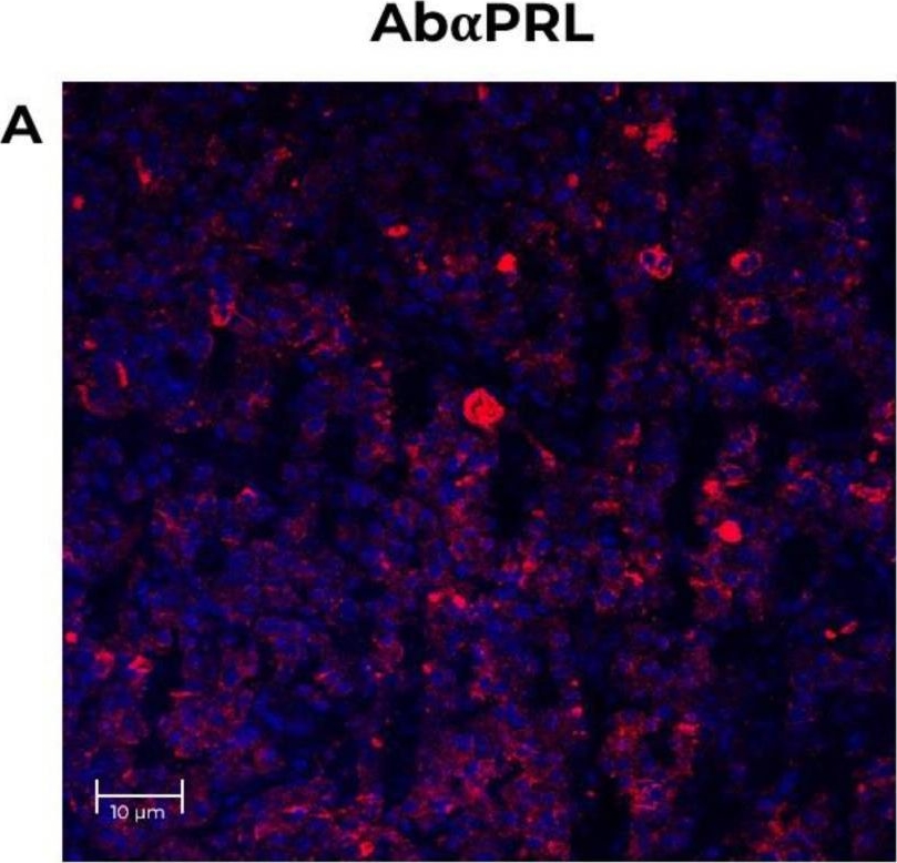 Fig.4.A showing Immunohistochemistry-immunofluorescence in a Papio hamadryas (Hamadryas baboon) sample from the publication: Prolactin Expression in the Baboon (Papio hamadryas) Eye.