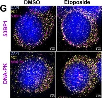 Fig.5.G showing Immunocytochemistry-immunofluorescence in a Mus musculus (House mouse) sample from the publication: The Redox Activity of Protein Disulphide Isomerase Functions in Non-Homologous End-Joining Repair to Prevent DNA Damage.