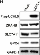 Fig.10.H showing Western Blotting from the publication: UCHL5 suppresses thyroid carcinoma progression via ZRANB1 stabilization and ferroptosis regulation.