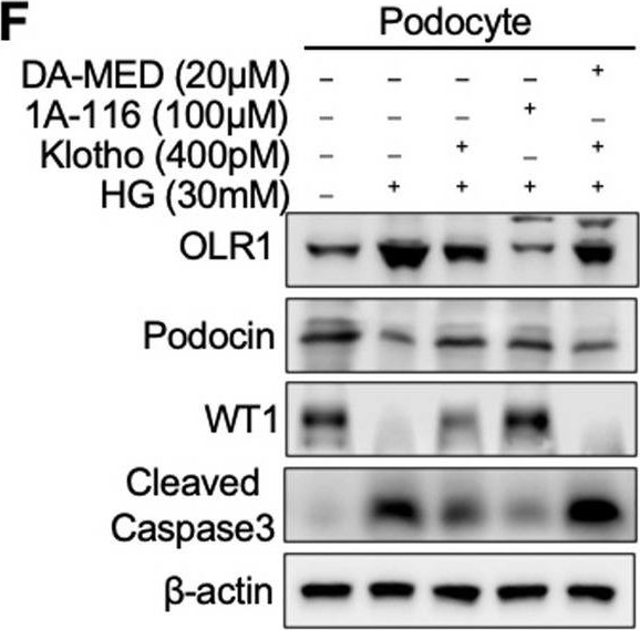 Fig.4.F showing Western Blotting from the publication: Klotho inhibits renal ox-LDL deposition via IGF-1R/RAC1/OLR1 signaling to ameliorate podocyte injury in diabetic kidney disease.
