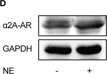 Fig.5.D showing Western Blotting in a Mus musculus (House mouse) sample from the publication: Sympathetic Denervation Ameliorates Renal Fibrosis via Inhibition of Cellular Senescence.