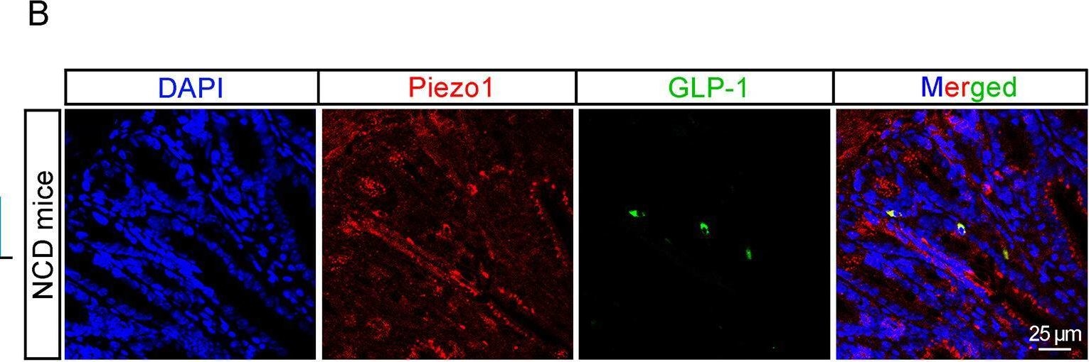 Fig.1.B showing Immunohistochemistry-immunofluorescence from the publication: Mechano-regulation of GLP-1 production by Piezo1 in intestinal L cells.