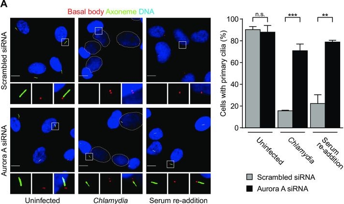 Fig.2.A showing Immunocytochemistry-immunofluorescence from the publication: Chlamydia trachomatis induces disassembly of the primary cilium to promote the intracellular infection.
