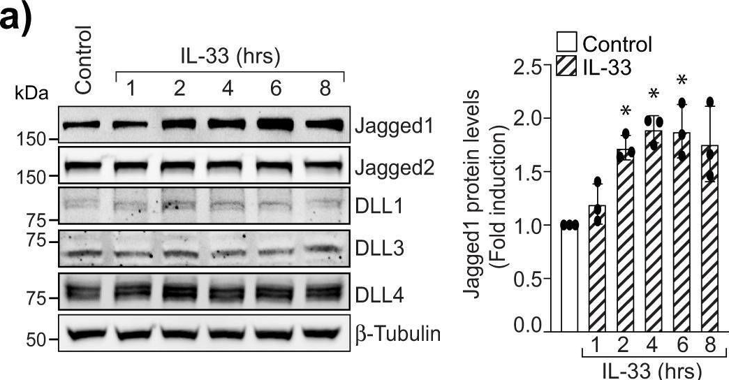 Fig.6.A showing Western Blotting from the publication: IL-33 enhances Jagged1 mediated NOTCH1 intracellular domain (NICD) deubiquitination and pathological angiogenesis in proliferative retinopathy.