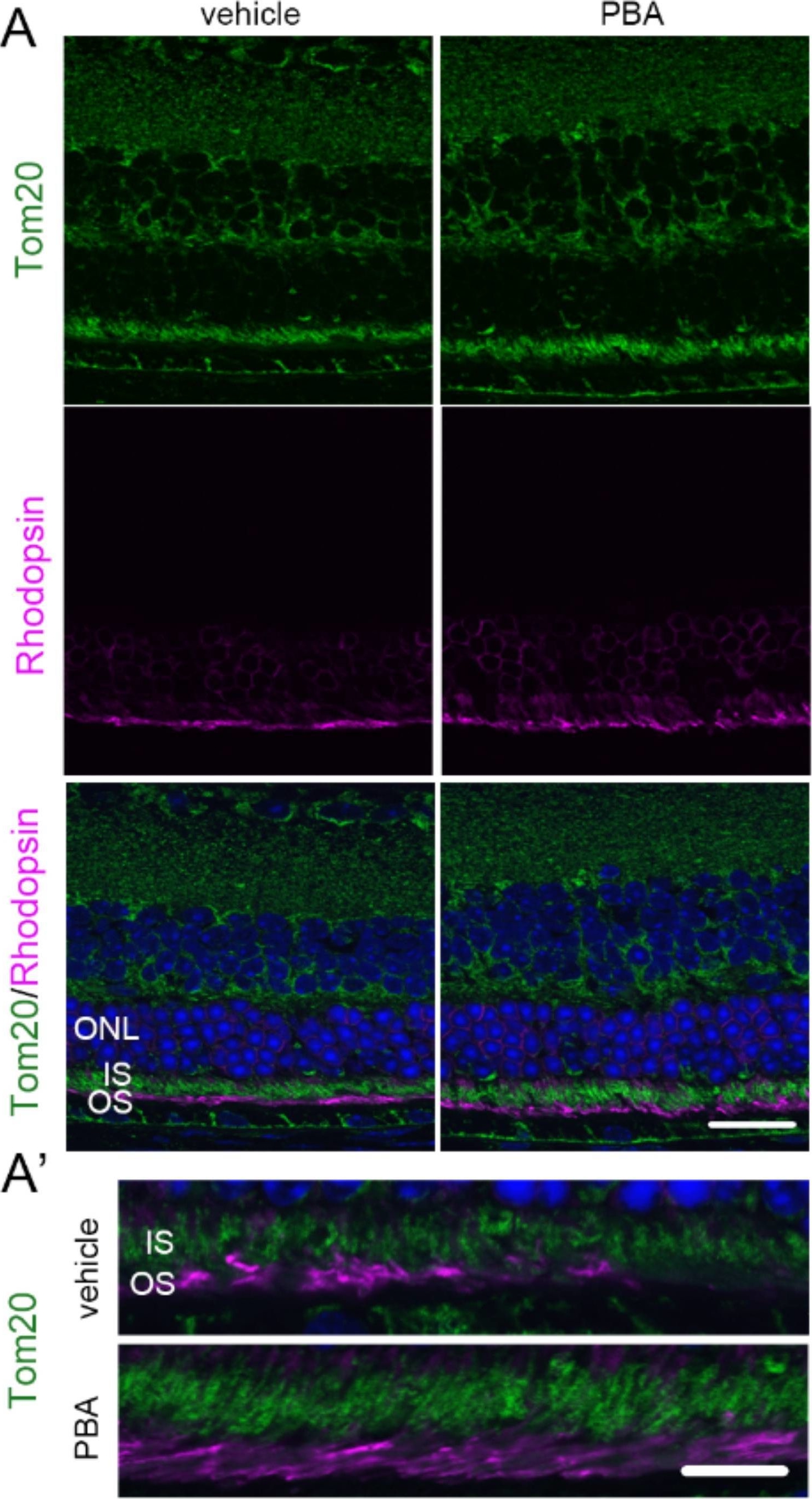 Fig.3.A showing Immunohistochemistry-paraffin-immunofluorescence in a Mus musculus (House mouse) sample from the publication: Effects of Epigenetic Modification of PGC-1α by a Chemical Chaperon on Mitochondria Biogenesis and Visual Function in Retinitis Pigmentosa.