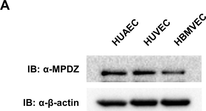 Fig.3.A showing Western Blotting in a Mus musculus (House mouse) sample from the publication: MPDZ promotes DLL4-induced Notch signaling during angiogenesis.