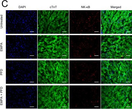 Fig.6.C showing Immunocytochemistry-immunofluorescence in a Rattus norvegicus (Rat) sample from the publication: Empagliflozin-pirfenidone dual therapy improves cardiac function and structure in a preclinical two-hit HFpEF model.
