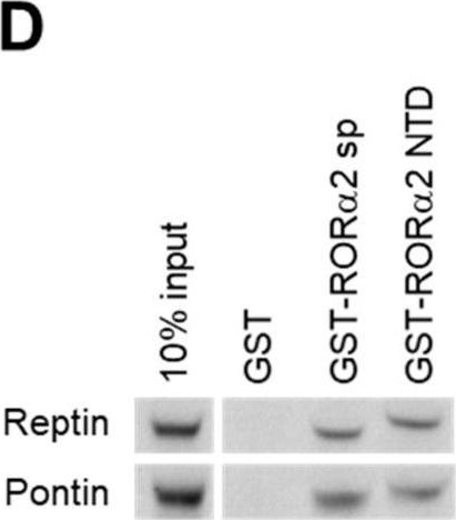 Fig.2.D showing Western Blotting from the publication: Isoform-Specific Lysine Methylation of RORα2 by SETD7 Is Required for Association of the TIP60 Coactivator Complex in Prostate Cancer Progression.