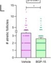 Fig.5.I from the publication: BGP-15 Treatment Improves Follicle Growth and Alters Collagen Deposition in Mouse Transplanted Ovaries.